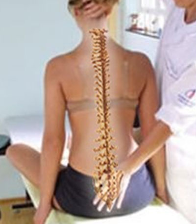 RPG – Reeducação Postural Global