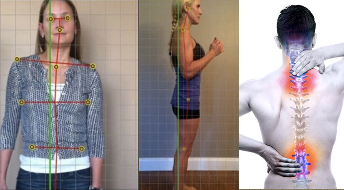 Avaliação Postural